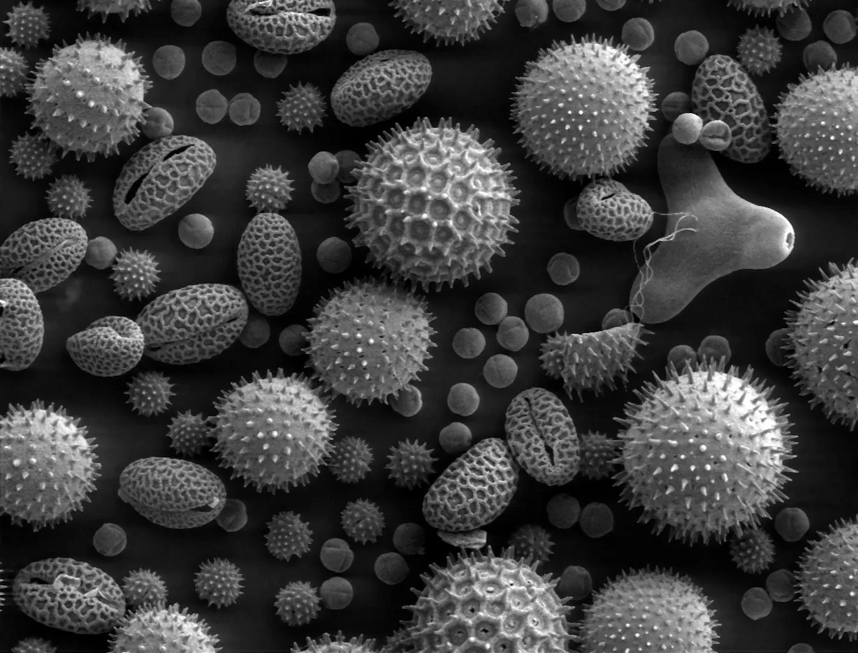 Le microscope électronique à balayage permet d'observer la structure nanométrique des échantillons